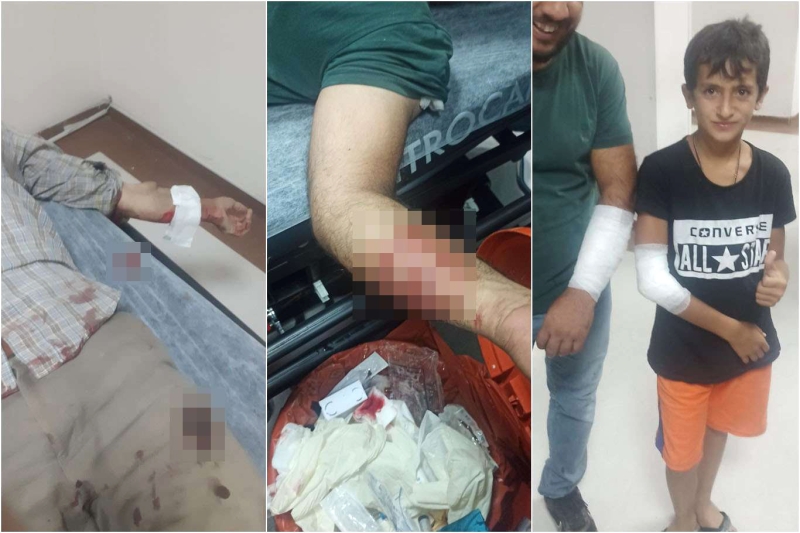 BİNGÖL’DE BAŞIBOŞ KÖPEK 4 KİŞİYİ YARALADI